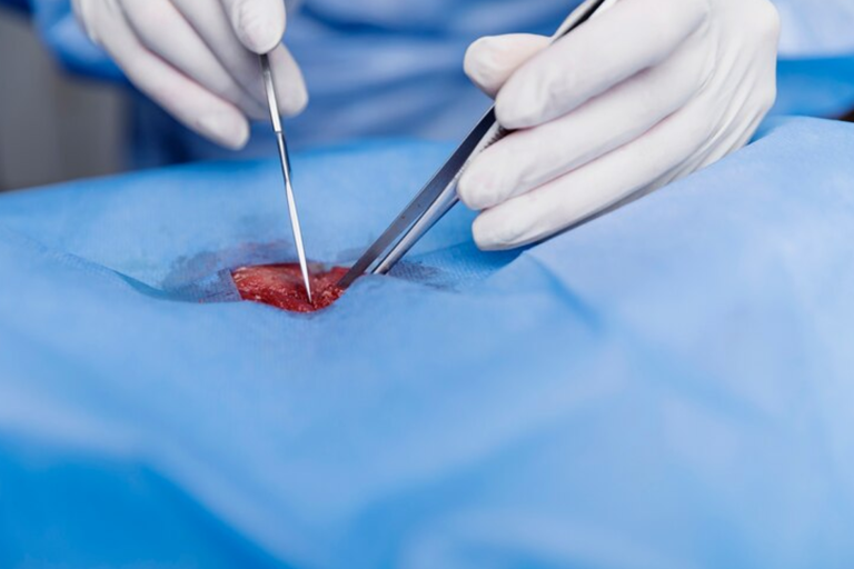 Hymenoplasty-Surgery
